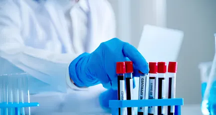 Blood Bank Technologist